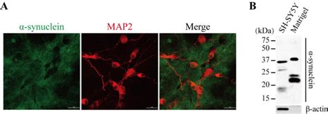 Fig S Matrigel And Synuclein A Immunofluorescence Staining Of