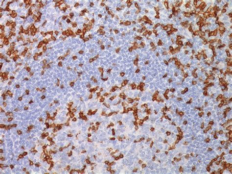 CD3 Antibody - Biocare Medical