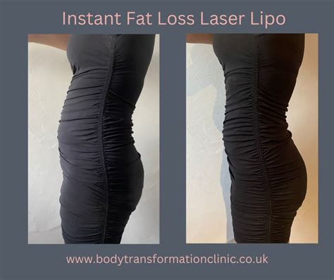 Laser Lipo Instant Fat Loss And Fat Reduction Dorset