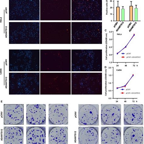 Proliferation Of Cervical Cancer Cells With PCMV ADAMTS12 Overexpressed