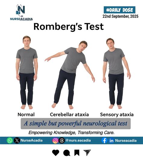 Teste De Romberg - 🧠 What is the Romberg’s Test? In neurological assessments, the Romberg ...