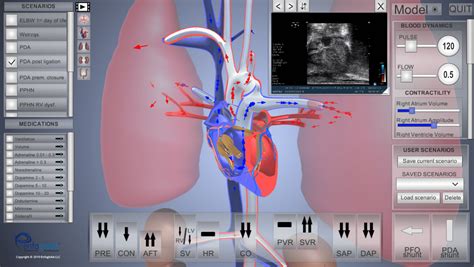 Pathology Simulation