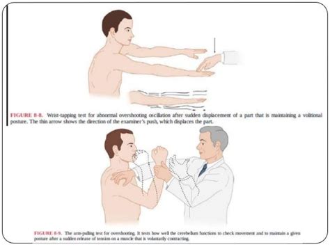 Cerebellar examination