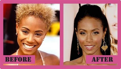 Jada Pinkett Smith Plastic Surgery - Facelift, Cheek Implants, & Botox