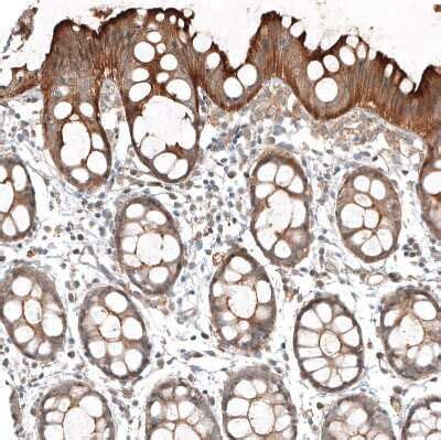 FAT1 Antibody NBP1 84565 Novus Biologicals