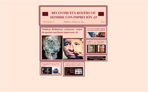 Hombre Le Reconstruyeron El Rostro Con Una Imresora 3D By DIANA JHASMIN