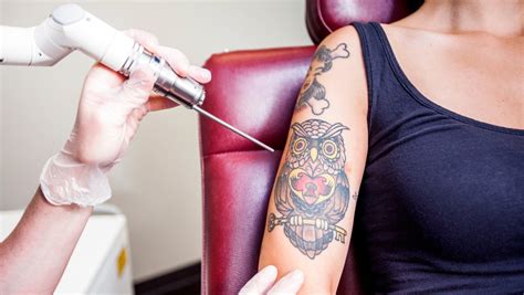 What Is Non Laser Tattoo Removal