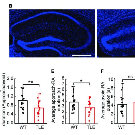 Kainic Acid Induced TLE Mice Showed Impairments In The Hippocampal