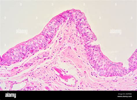 Ureter hi-res stock photography and images - Alamy