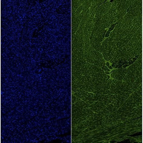 Transmural section of heart wall from a 4.3-month old animal from... | Download Scientific Diagram