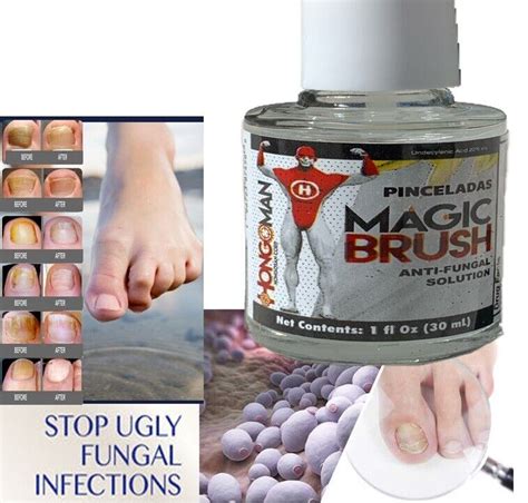 Hongosan Natural Life Nail Fungus Away Anti Fungal Toenail Nail Foot