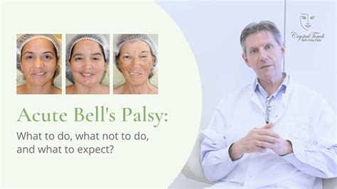 Crystal Touch Bells Palsy Clinic