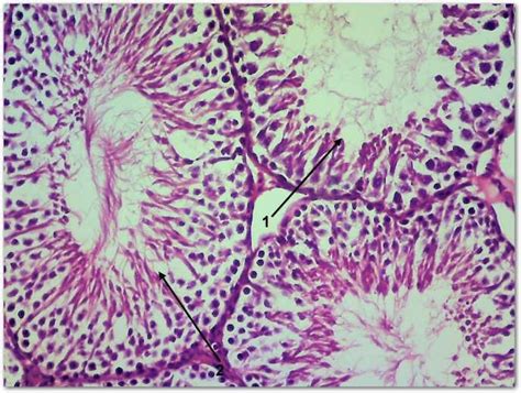 Transverse Sections In Rat Testis From The Eight Weeks Alcl 3 Curcuma Download Scientific