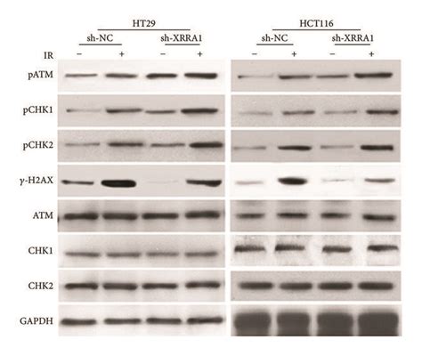 Downregulated Expression Of Xrra In Crc Cells Regulates Atm Chk