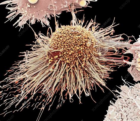 Activated Macrophage Sem Stock Image C0156375 Science Photo Library