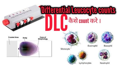 Dlc Test Differential Leukocyte Count Dlc Dlctest Youtube