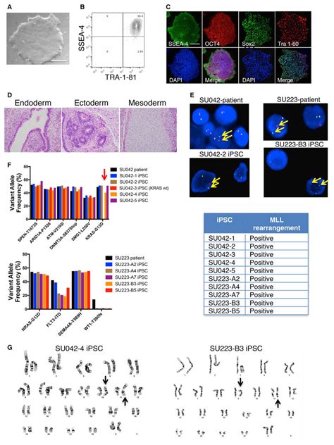 Human Aml Cells Can Be Reprogrammed Into Ipscs While Retaining The