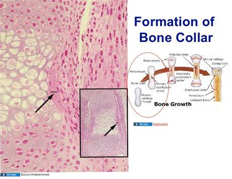 101308 Histology Bone Formation And Remodeling