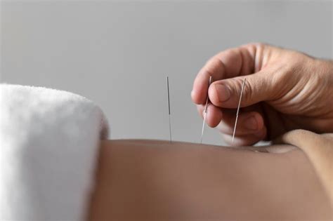 Dry Needling Vs Acupuncture Are They The Same Oni Physio Fitness