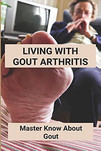 Living With Gout Arthritis Master Know About Gout Should I Walk With