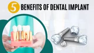 Ppt Top Benefits Of Dental Veneers Powerpoint Presentation Free