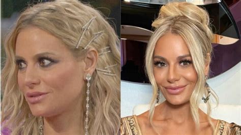 Dorit Kemsley Before Plastic Surgery Boob Job Facelift Botox