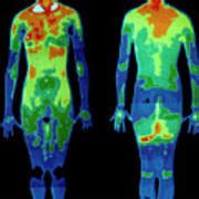 Thermogram Naked Woman Standing Photograph By Dr Ray Clark Mervyn