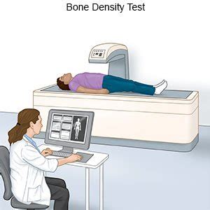 Bone Density Test - What You Need to Know