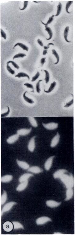 Phase Contrast And Corresponding Fluorescence Micrographs Of Sperm