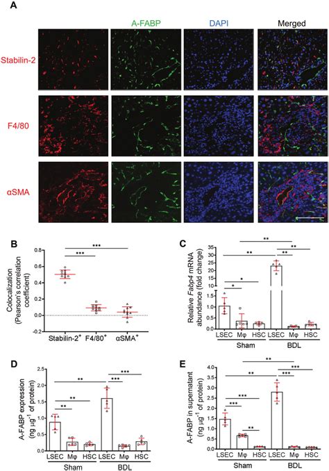 LSEC Is The Major Hepatocellular Source Of A FABP In BDL Induced Liver