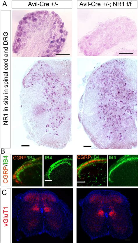 NR1 Subunit Is Specifically Deleted In The DRG Sensory Neurons Of The