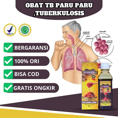 Jual Obat TBC Paru Asma Sesak Nafas Radang Paru Paru Bronkitis