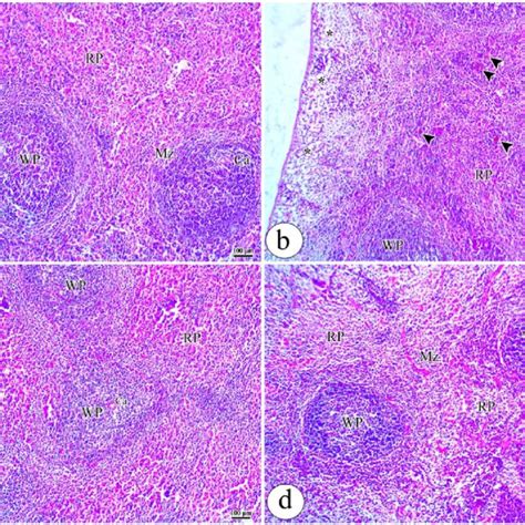 Photomicrographs Of Rat Spleen Stained With H E Stain Presenting A