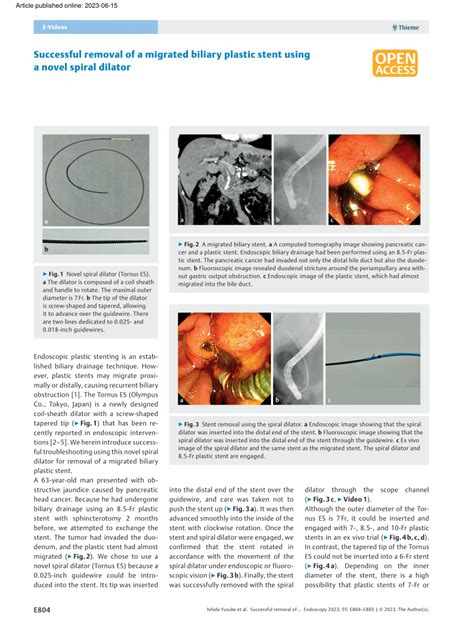 (PDF) Successful removal of a migrated biliary plastic stent using a ...