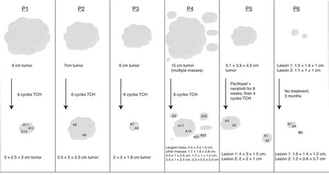 Longitudinal Multi Region Her2 Positive Breast Cancer Cohort