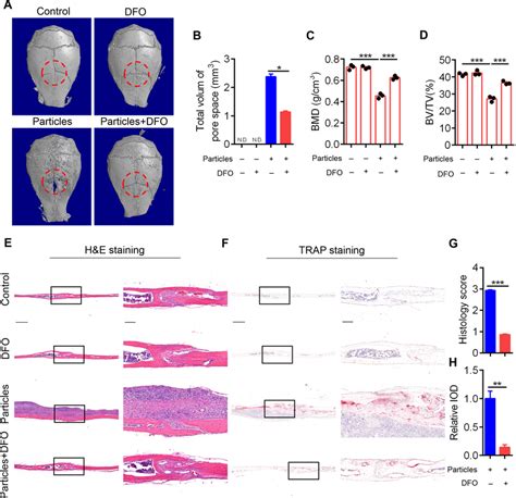 DFO Alleviates UHMWPE Particle Induced Calvarial Osteolysis