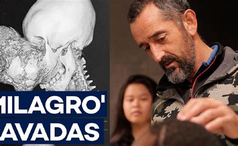 El Doctor Cavadas Extirpa Un Tumor Gigante De 13 Kilos