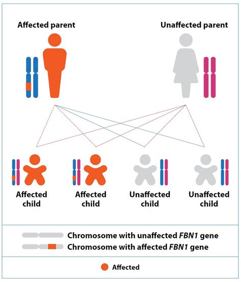 Marfans Syndrome What It Is Causes Treatments Singhealth