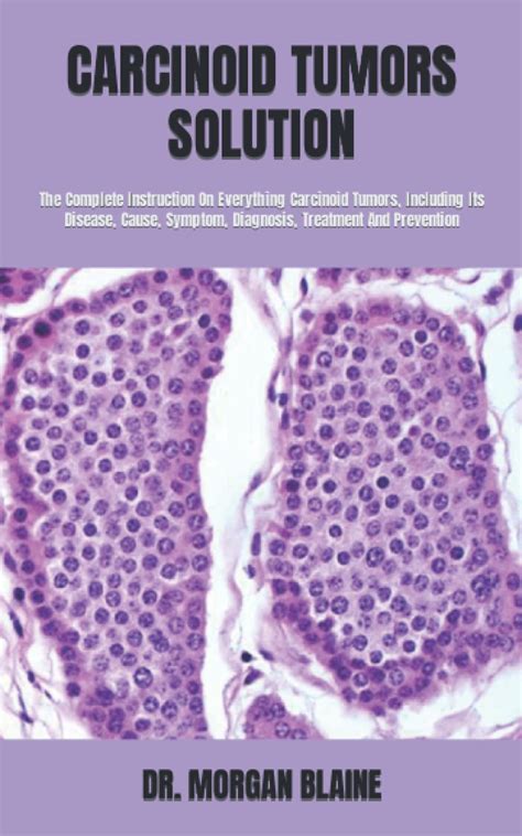 Buy Carcinoid Tumors Solution The Complete Instruction On Everything