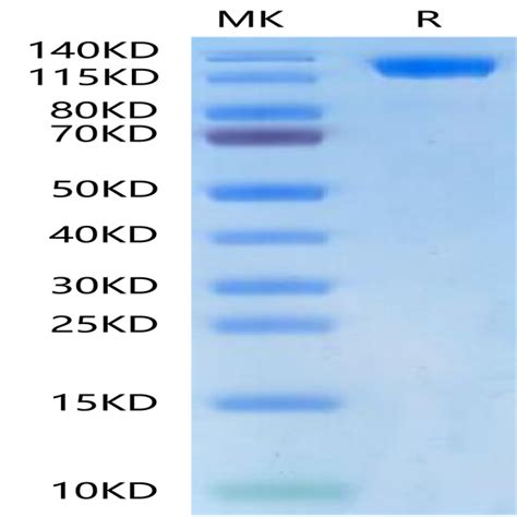 Biotinylated Human Ace Aceh Protein Ace Hm B Kactus Biosystems