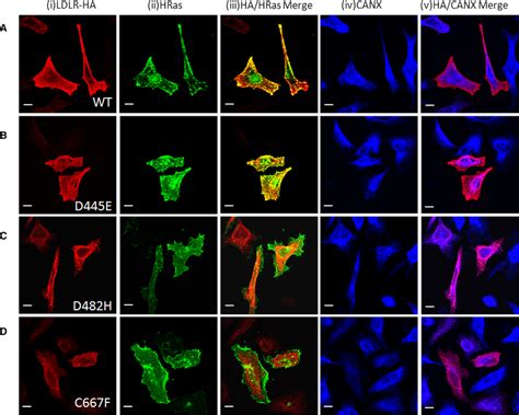 Comparison Of Intracellular Localization Of Ldlr Wildtype And Mutant