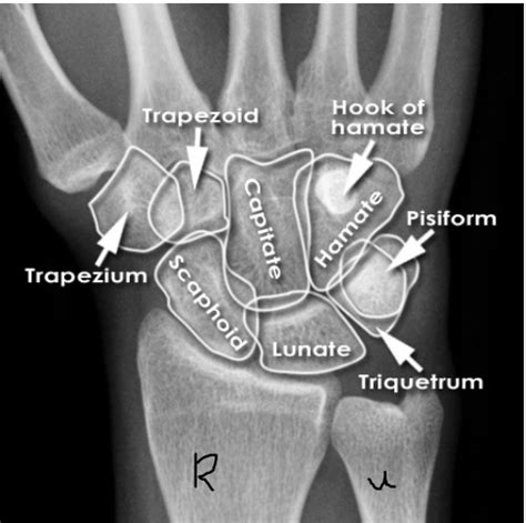 Wrist Forearm Elbow Worksheet Flashcards Quizlet