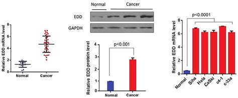 Edd Expression Levels Are Upregulated In Cervical Cancer Tissue Samples