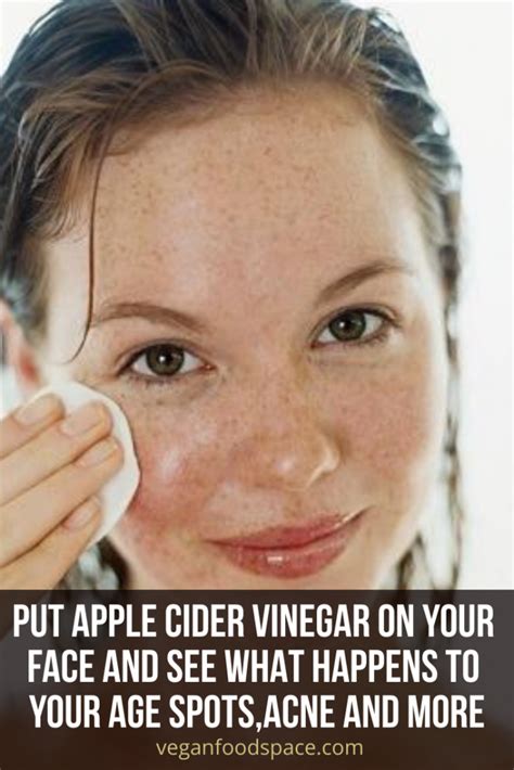 Put Apple Cider Vinegar On Your Face And See What Happens To Your Age Spotsacne And More