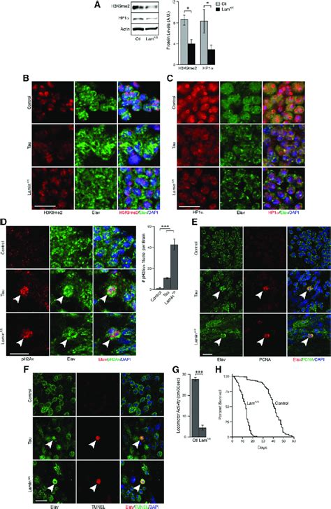 Lamin Dysfunction Causes Neurodegeneration Heterochromatin Relaxation