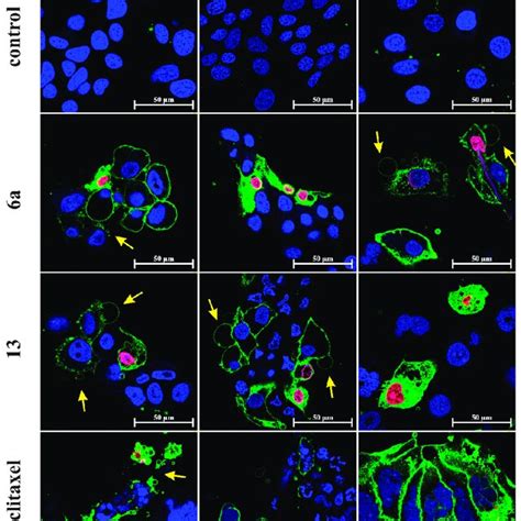 Apoptosis Necrosis Detection Assay On Fadu Detroit 562 And SCC 25