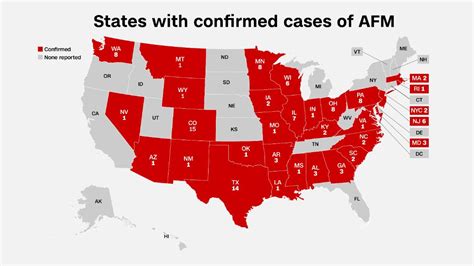 Afm Cdc Identifies 31 States With 116 Confirmed Cases Of Polio Like