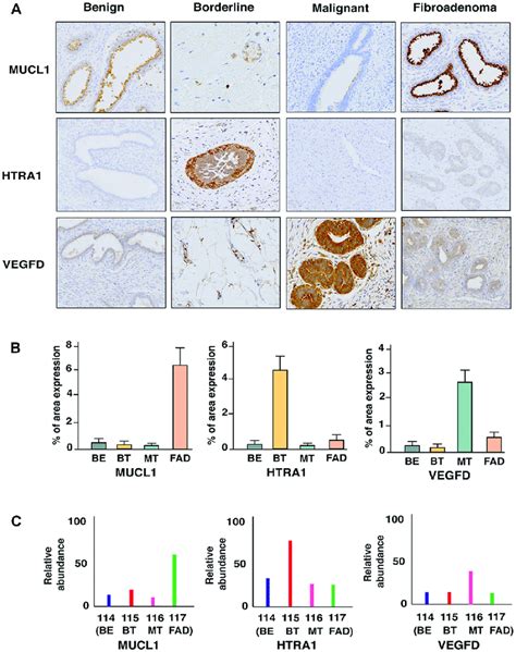 A Immunohistochemical Staining Of MUCL1 HTRA1 And VEGFD Which Are