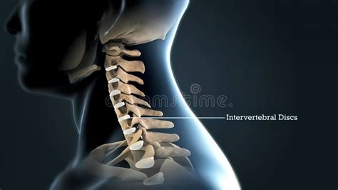 Lumbar Spine with Nerves stock illustration. Illustration of pain ...