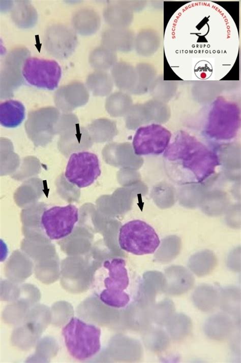 Sociedad Argentina de Hematología